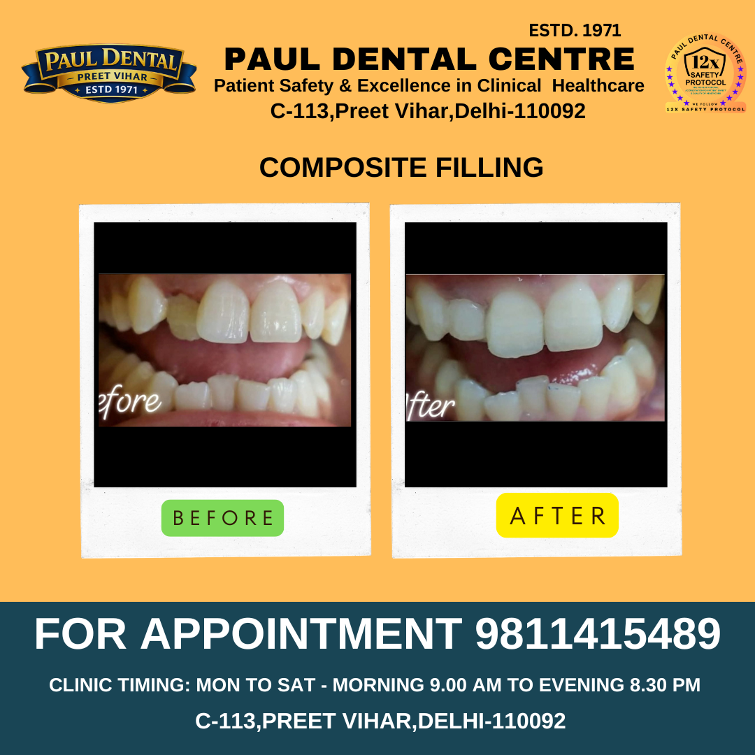 Case 27 – Paul Dental Center